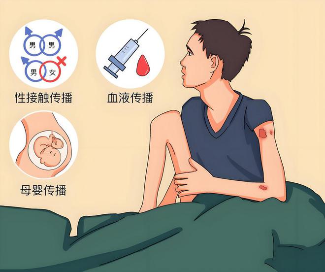 一旦感染艾滋病，多久能被发觉？可能多数人以为是皮肤病，要分清