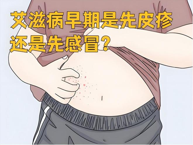 一旦感染艾滋病，多久能被发觉？可能多数人以为是皮肤病，要分清