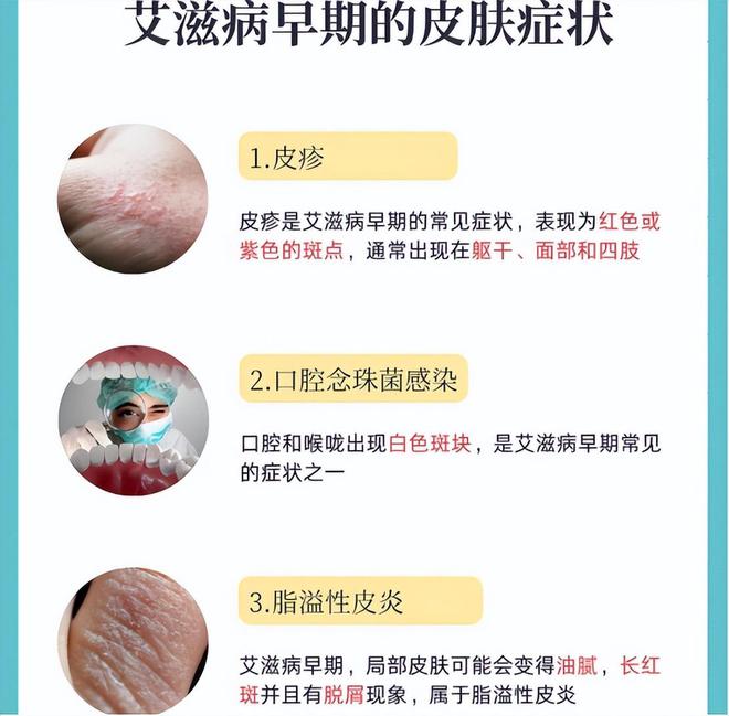 一旦感染艾滋病，多久能被发觉？可能多数人以为是皮肤病，要分清